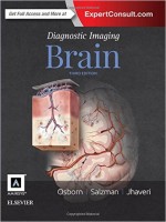 Diagnostic Imaging: Brain, 3rd Edition